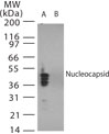 NB100-56049 - SARS N