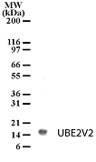 NB100-56360 - UBE2V2