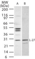 NB100-56389 - Interleukin-27 / IL27A