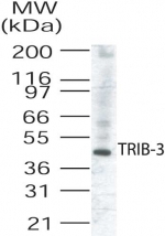 NB100-56398 - TRIB3