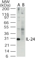 NB100-56407 - Interleukin-24 / IL24