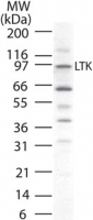 NB100-56425 - LTK / TYK1