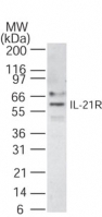 NB100-56439 - Interleukin-21 receptor / IL21R