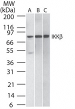 NB100-56509 - IKBKB / IKKB