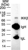 NB100-56513 - IKBKB / IKKB