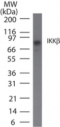 NB100-56513 - IKBKB / IKKB