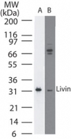 NB100-56548 - BIRC7 / LIVIN