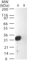 NB100-56569 - SARS M