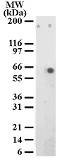 NB100-56594 - ATF2