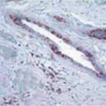 NB100-56598 - Retinoblastoma-associated protein / RB1
