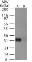NB100-56607 - Influenza A H5N1