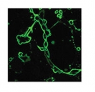 NB100-56608 - Influenza A H5N1