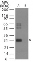 NB100-56611 - Influenza A H5N1