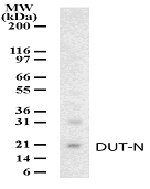 NB100-56624 - DUT