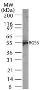 NB100-56659 - RGS6