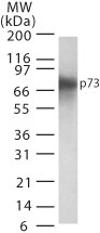 NB100-56674 - Tumor protein p73 (TP73)