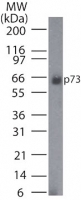NB100-56674 - Tumor protein p73 (TP73)