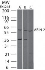 NB100-56701 - TNIP2