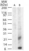 NB100-56743 - West Nile Virus