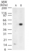 NB100-56744 - West Nile Virus