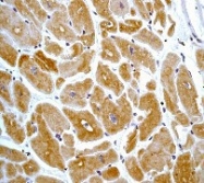 NB110-56931 - Desmin