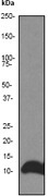 NB110-56932 - DYNLL1