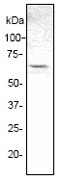 NB110-56953 - ELK1