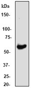 NB110-56961 - Estrogen receptor alpha