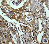 NB110-56979 - MAPK3 / ERK1