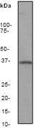 NB110-57028 - Heme oxygenase 1 / HMOX1