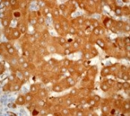NB110-57028 - Heme oxygenase 1 / HMOX1