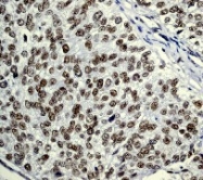 NB110-57033 - HDAC3