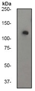 NB110-57034 - HDAC4