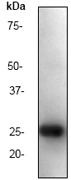 NB110-57054 - HIV-1