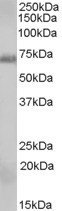 NB100-57077 - RAD9A