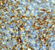 NB110-57106 - CD54 / ICAM1