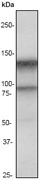 NB110-57107 - IFNAR1