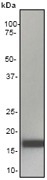 NB110-57112 - Interleukin-1 beta / IL-1B