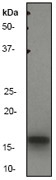 NB110-57113 - Interleukin-1 beta / IL-1B
