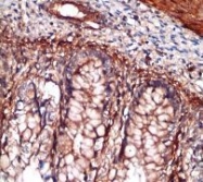 NB110-57122 - Indian hedgehog protein / IHH