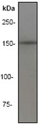 NB110-57129 - IRS1