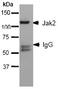 NB110-57144 - Tyrosine-protein kinase JAK2