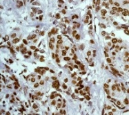 NB110-57144 - Tyrosine-protein kinase JAK2