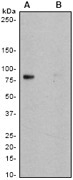 NB110-57163 - CD18 / ITGB2