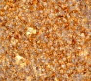 NB110-57163 - CD18 / ITGB2