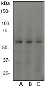 NB110-57313 - Tumor protein p73 (TP73)