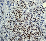 NB110-57313 - Tumor protein p73 (TP73)