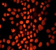 NB110-57458 - Retinoblastoma-associated protein / RB1