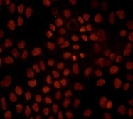 NB110-57458 - Retinoblastoma-associated protein / RB1