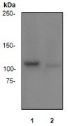 NB110-57460 - Retinoblastoma-associated protein / RB1